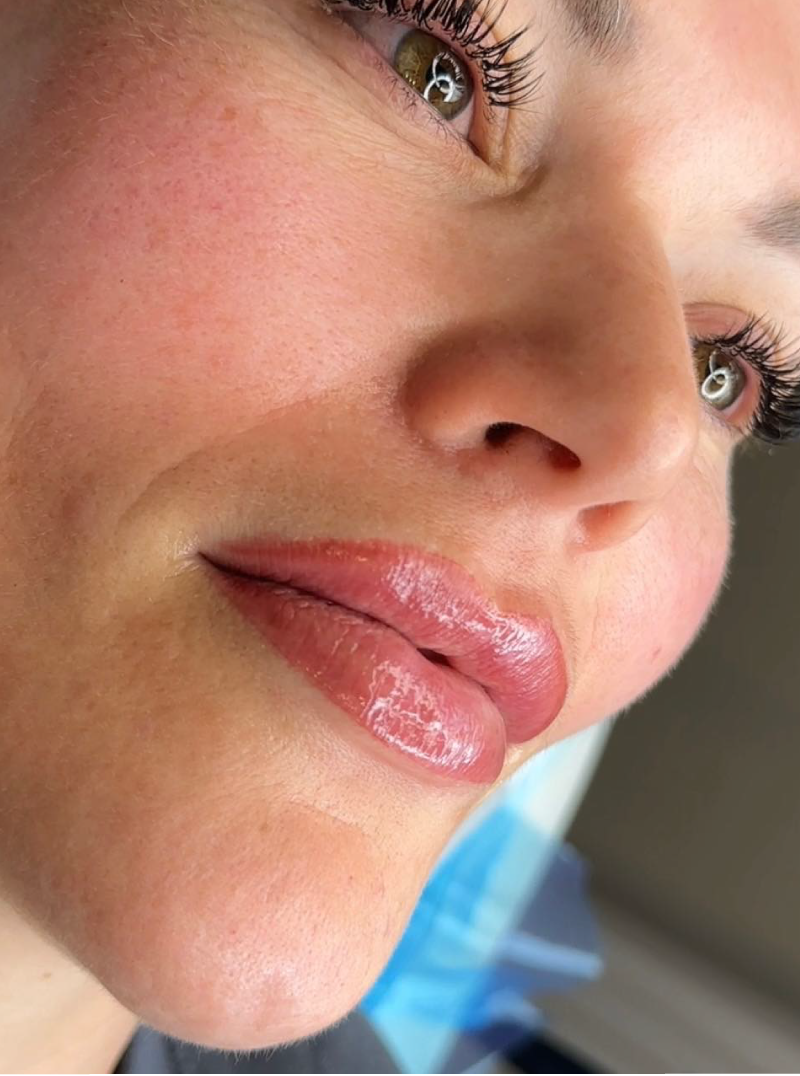 lip-blush
